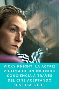 Vicky Knight: la actriz víctima de un incendio conciencia a través del cine aceptando sus cicatrices
